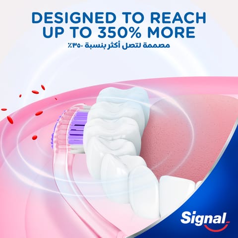 Usmile Ultrasonic Oral CY0 White