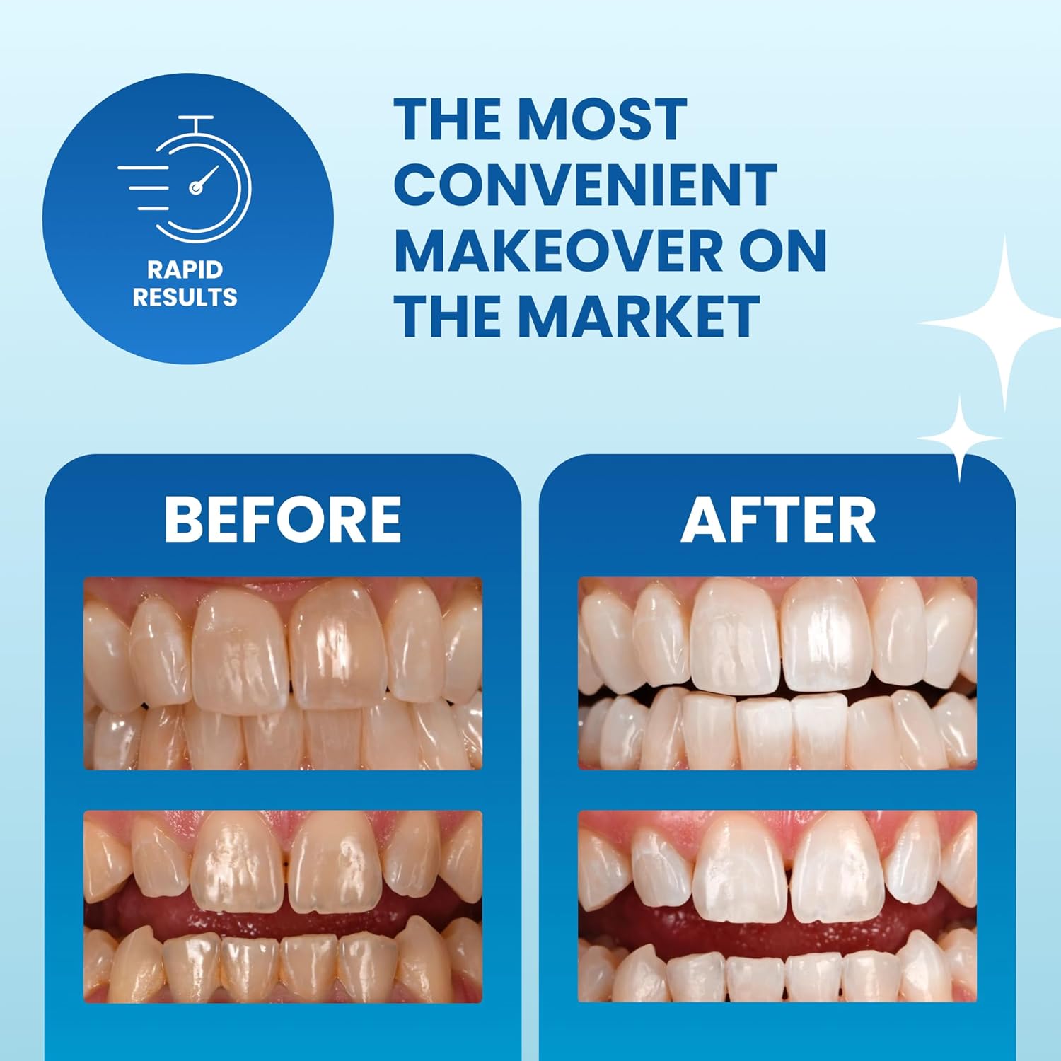 Poof! Teeth Whitening 20 Strip Pack